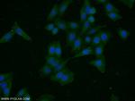 HER2/ErbB2 Antibody in Immunocytochemistry (ICC/IF)