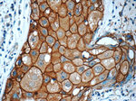 HER2/ErbB2 Antibody in Immunohistochemistry (Paraffin) (IHC (P))