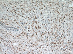 HER2/ErbB2 Antibody in Immunohistochemistry (Paraffin) (IHC (P))