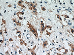 HER2/ErbB2 Antibody in Immunohistochemistry (Paraffin) (IHC (P))