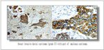 HER2/ErbB2 Antibody in Immunohistochemistry (IHC)