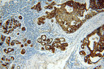 HER2/ErbB2 Antibody in Immunohistochemistry (Paraffin) (IHC (P))