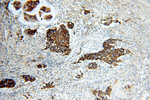 HER2/ErbB2 Antibody in Immunohistochemistry (Paraffin) (IHC (P))