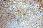 HER2/ErbB2 Antibody in Immunohistochemistry (Paraffin) (IHC (P))