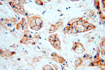 HER2/ErbB2 Antibody in Immunohistochemistry (Paraffin) (IHC (P))