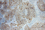 HER2/ErbB2 Antibody in Immunohistochemistry (Paraffin) (IHC (P))