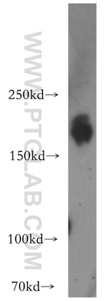 HER2/ErbB2 Antibody in Western Blot (WB)