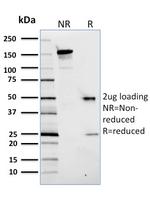 PCNA (Proliferating Cell Nuclear Antigen) (G1- and S-phase Marker) Antibody in SDS-PAGE (SDS-PAGE)