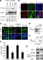 SMAD2 Antibody in Western Blot (WB)