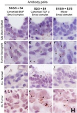 SMAD2 Antibody in Immunohistochemistry (IHC)