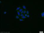 PAK1 Antibody in Immunocytochemistry (ICC/IF)