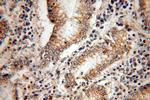 PAK1 Antibody in Immunohistochemistry (Paraffin) (IHC (P))