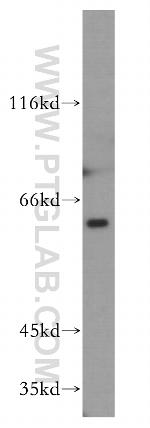 PAK1 Antibody in Western Blot (WB)