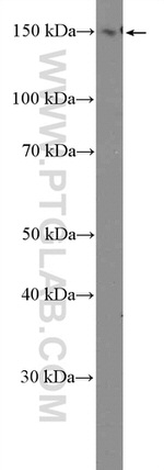 PLCB3 Antibody in Western Blot (WB)