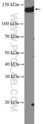 PLCB3 Antibody in Western Blot (WB)