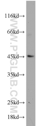 MEK4 Antibody in Western Blot (WB)