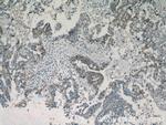 MEK4 Antibody in Immunohistochemistry (Paraffin) (IHC (P))