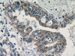 MEK4 Antibody in Immunohistochemistry (Paraffin) (IHC (P))