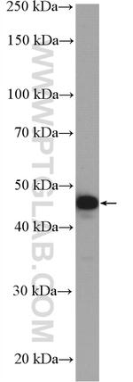 MEK4 Antibody in Western Blot (WB)