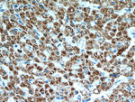 SMAD4 Antibody in Immunohistochemistry (Paraffin) (IHC (P))