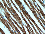 SMAD4 Antibody in Immunohistochemistry (Paraffin) (IHC (P))