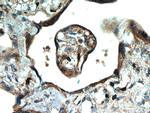 SMAD4 Antibody in Immunohistochemistry (Paraffin) (IHC (P))