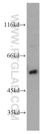 SMAD4 Antibody in Western Blot (WB)