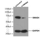 SMAD4 Antibody in Western Blot (WB)