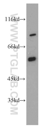 SMAD4 Antibody in Western Blot (WB)