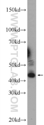 JNK Antibody in Western Blot (WB)