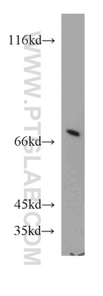 ATP6V1A Antibody in Western Blot (WB)