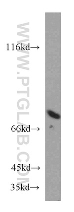 ATP6V1A Antibody in Western Blot (WB)