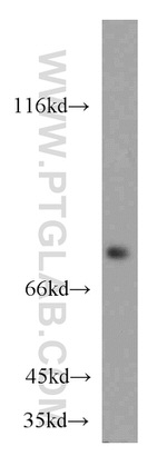 ATP6V1A Antibody in Western Blot (WB)