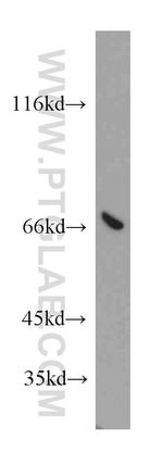 ATP6V1A Antibody in Western Blot (WB)