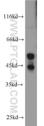 JNK2 Antibody in Western Blot (WB)