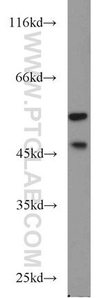 JNK2 Antibody in Western Blot (WB)