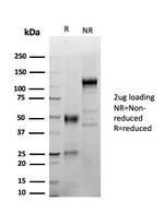 LEF1/TCF1 alpha (Transcription Factor) Antibody in SDS-PAGE (SDS-PAGE)