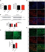 LAMP-2A Antibody in Immunohistochemistry (IHC)