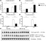 beta Amyloid Antibody in Western Blot (WB)