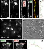 beta Amyloid Antibody in Immunocytochemistry (ICC/IF)