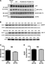 beta Amyloid Antibody in Western Blot (WB)