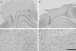 beta Amyloid Antibody in Immunohistochemistry - Free Floating (IHC (Free))