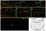 beta Amyloid Antibody in Immunohistochemistry (IHC)