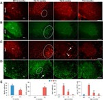 beta Amyloid Antibody in Immunohistochemistry (IHC)