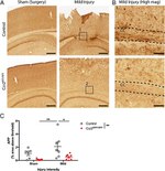 beta Amyloid Antibody in Immunohistochemistry (IHC)