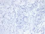 PDCD1/PD1/CD279 (Programmed Cell Death 1) Antibody in Immunohistochemistry (Paraffin) (IHC (P))