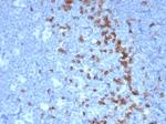 PDCD1/PD1/CD279 (Programmed Cell Death 1) Antibody in Immunohistochemistry (Paraffin) (IHC (P))