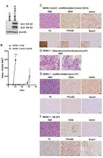 ALK Antibody in Western Blot (WB)