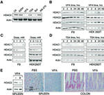 HDAC2 Antibody