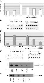 HDAC2 Antibody in Western Blot, Immunoprecipitation (WB, IP)